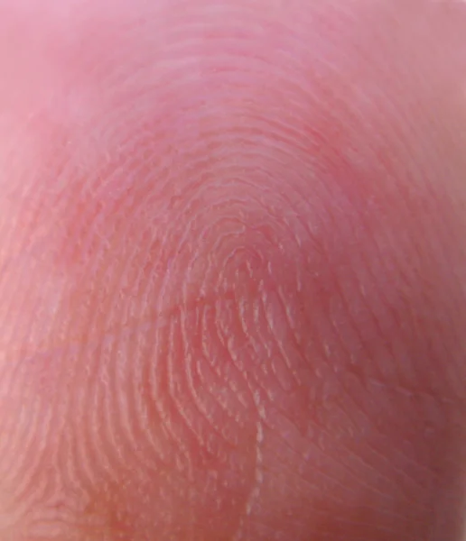Intricate pattern on a thumb — Stock Photo, Image
