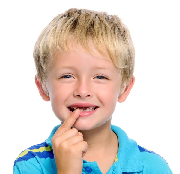 Rapaz sem dentes — Fotografia de Stock
