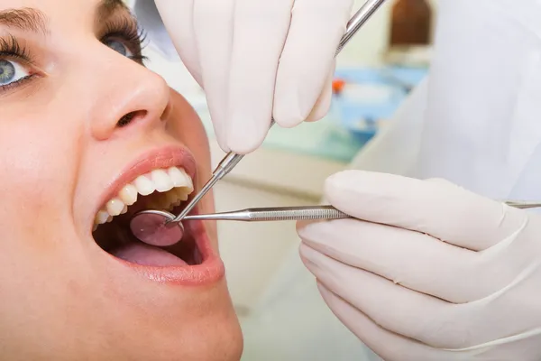 Tandheelkundige inspectie — Stockfoto