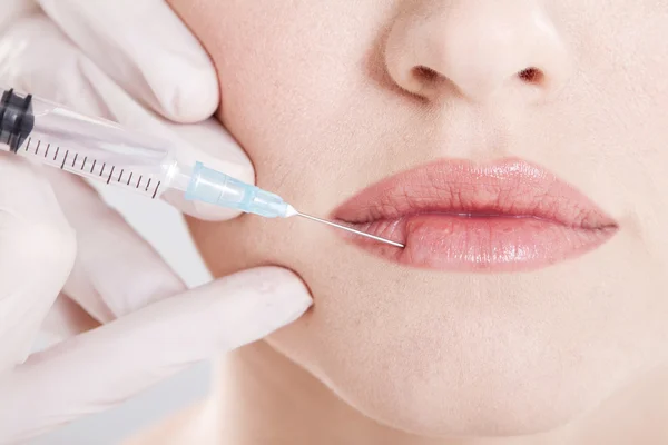Mulher a receber uma injeção no lábio — Fotografia de Stock