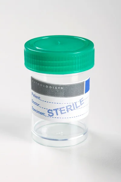 Пустая медицинская стерильная бутылка для сбора образцов — стоковое фото