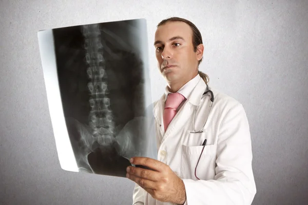 Radiography bone — Stock Photo, Image