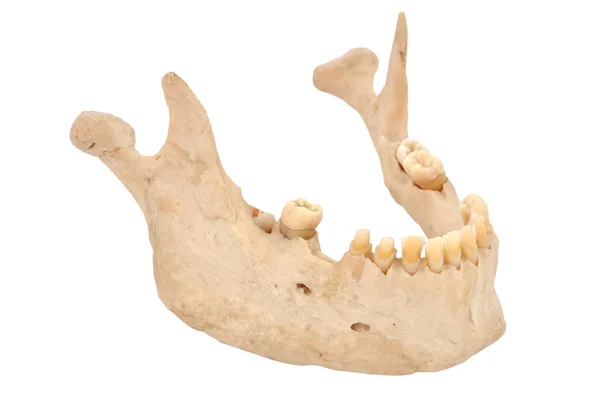 stock image Lower jaw