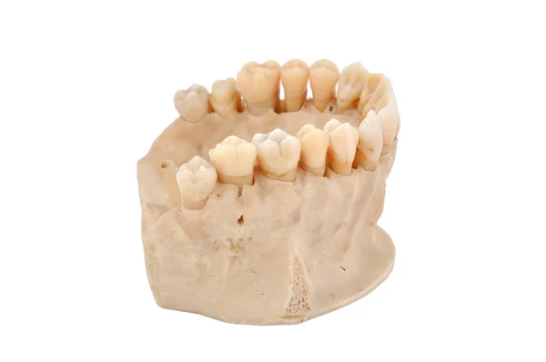 Upper jawbone — Stock Photo, Image