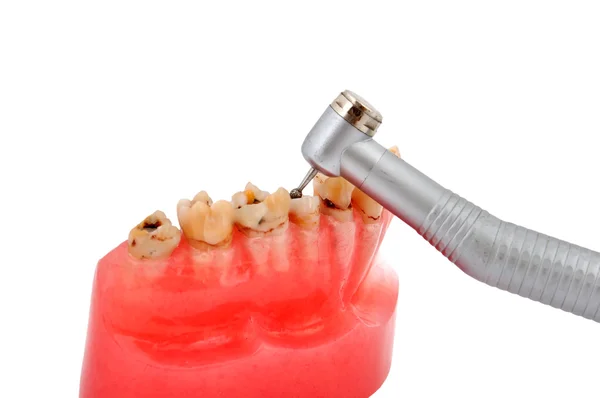 Kiefer und Zahnhandstück — Stockfoto