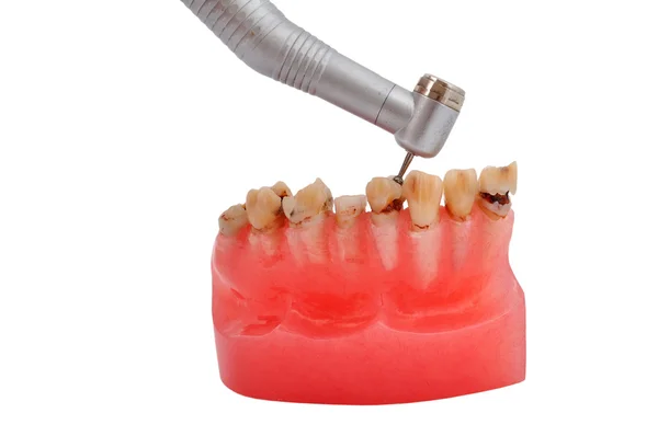 Kaak en tandheelkundige handinstrument — Stockfoto