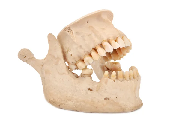Human jaw — Stock Photo, Image