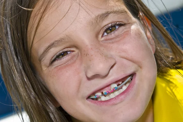 Close up Girl With Braces — Stock Photo, Image