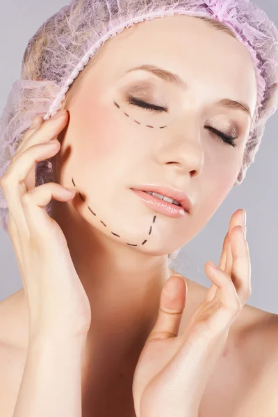 Mulher bonita, com linhas de perfuração no rosto antes da cirurgia plástica — Fotografia de Stock