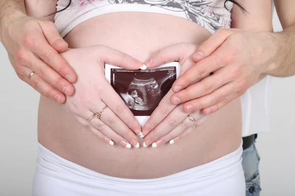 Беременная женщина с ультразвуковой картинкой — стоковое фото