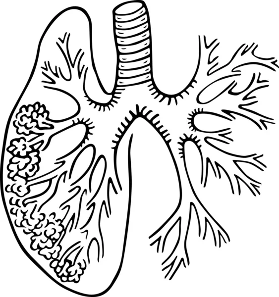 Lidský plíce — Stockový vektor