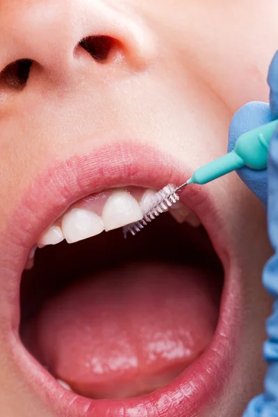 치아 관리 — 스톡 사진