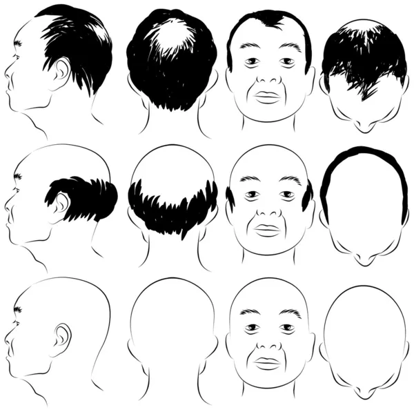 Asian Male Baldness Pattern — Stock Vector