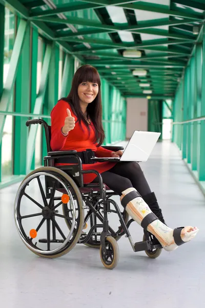 Mulher com a perna quebrada — Fotografia de Stock
