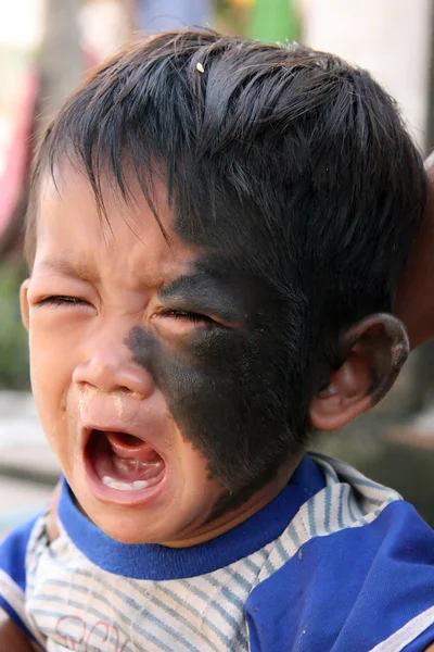 Menino com pele no rosto - Sihanoukville, Camboja — Fotografia de Stock