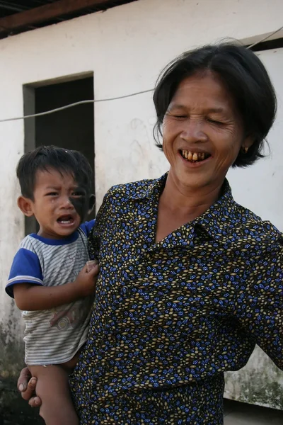 在脸上-西哈努克城、 柬埔寨毛皮的男孩 — 图库照片