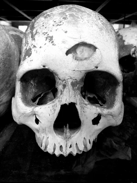 Skull - The Killing Fed of Choeung Ek, Phnompenh, Cambodia — стоковое фото