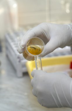 laboratuvar test 3