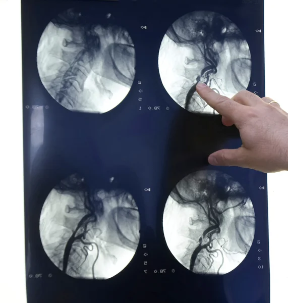 Radiology new 2 — Stock Photo, Image