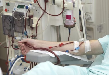 Dialysis health care medicine kidney clipart