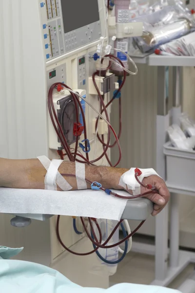 Dialys sjukvård medicin njure — Stockfoto
