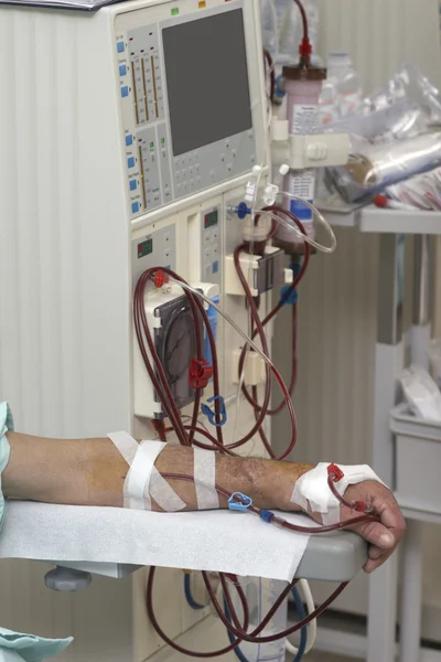Dialysis health care medicine kidney — Stock Photo, Image