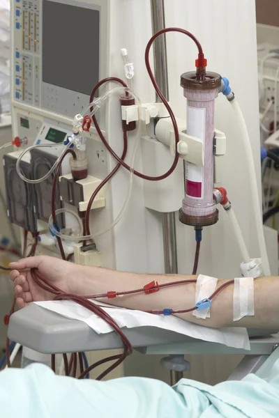 Dialyse gezondheidszorg geneeskunde nier — Stockfoto