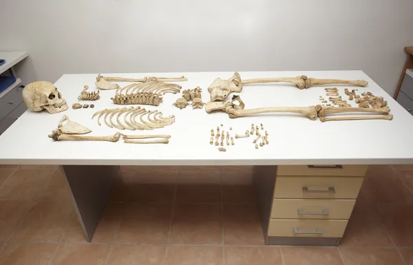 Skeleton schedel botten — Stockfoto