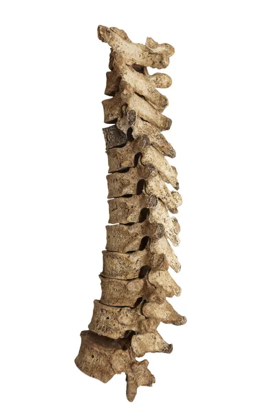 Esqueleto ossos do crânio — Fotografia de Stock