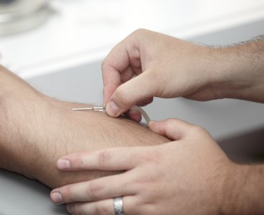 Laboratuvar kan testi ayıklama Tıp Sağlık