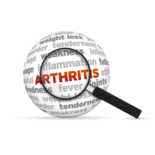 Artrite — Foto Stock