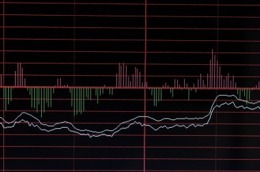 Borsa billboard analiz eğrileri ile