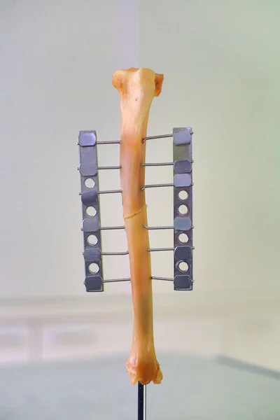 Menschliches Bein oder Handknochen als Objekt — Stockfoto