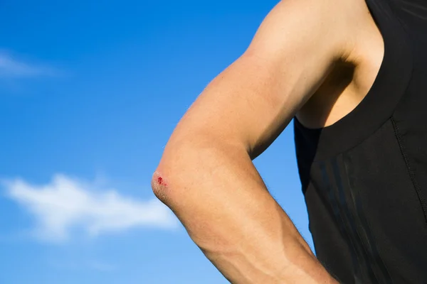 View on sportsman injury after some fall — Stock Photo, Image