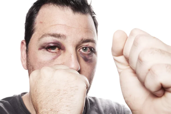 Podbite oko szkody bokser przemocy na białym tle — Zdjęcie stockowe