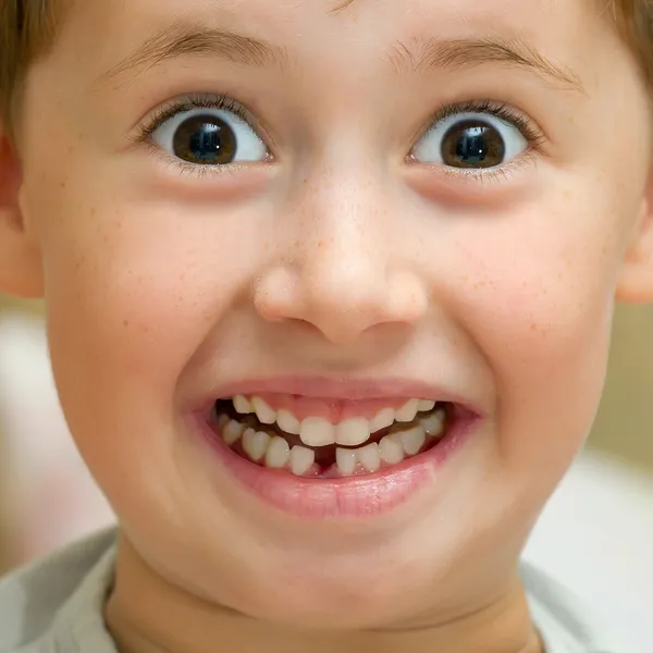 stock image Boy smiling without one teeth