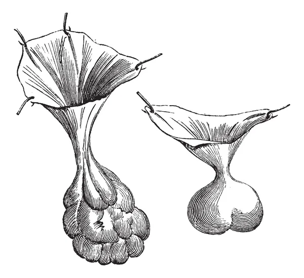 Fig. 594. Due diversi tipi di sacchi erniari., incisione vintage — Vettoriale Stock