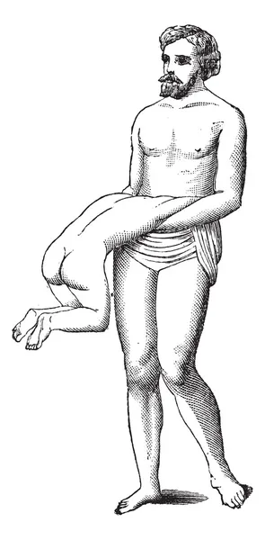 Fig. 600. Twin omgekeerd arteriële perfusie, vintage gravure. — Stockvector