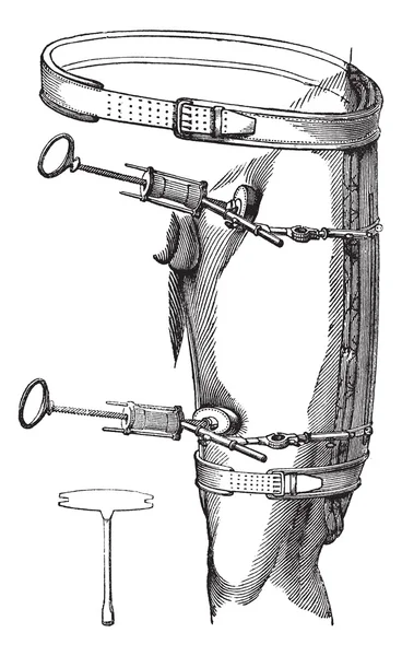 Fig. 89. compression des jambes de l'aorte à l'aide d'une compression des jambes pour — Image vectorielle