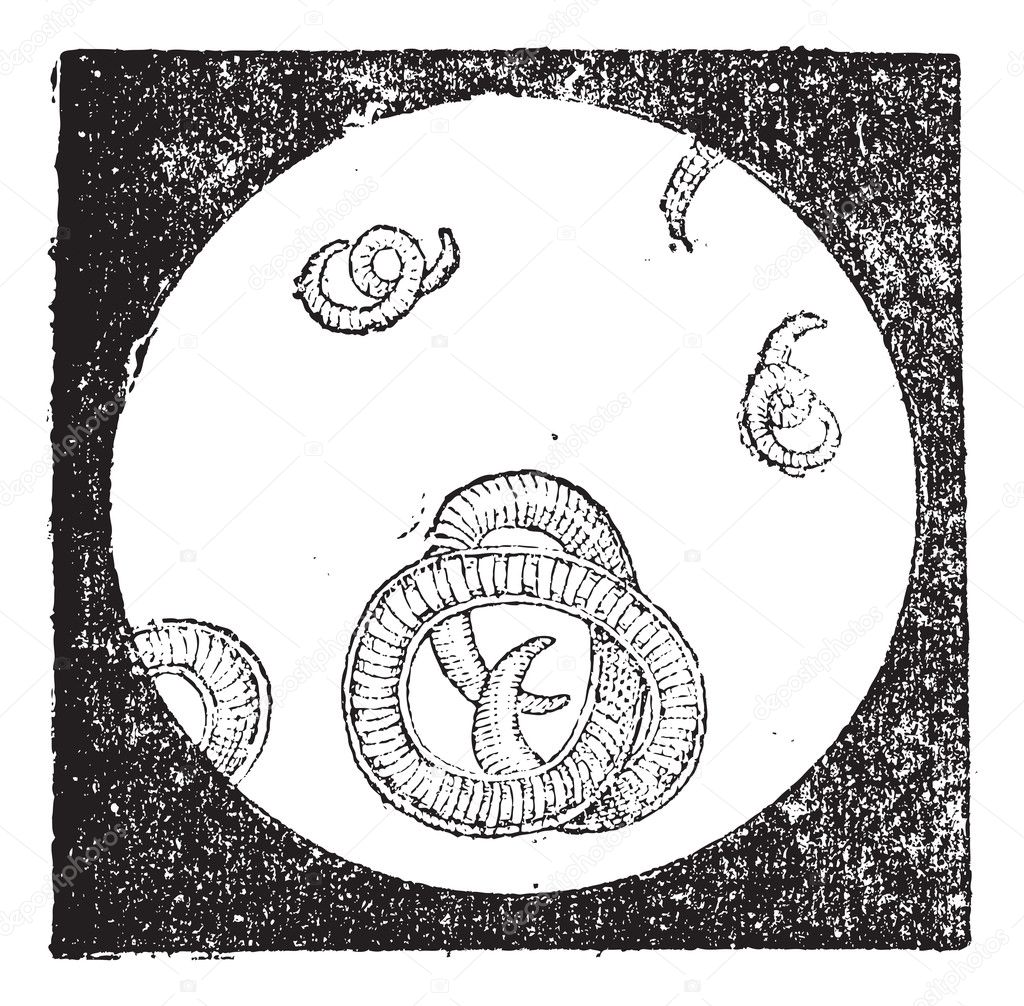 Trichinella or trichina worms, vintage engraving.