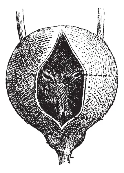 Мочевой пузырь человека, винтажная гравировка — стоковый вектор