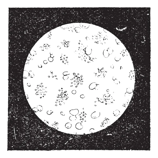 Leche de vaca enferma, vista microscópica, grabado vintage . — Archivo Imágenes Vectoriales