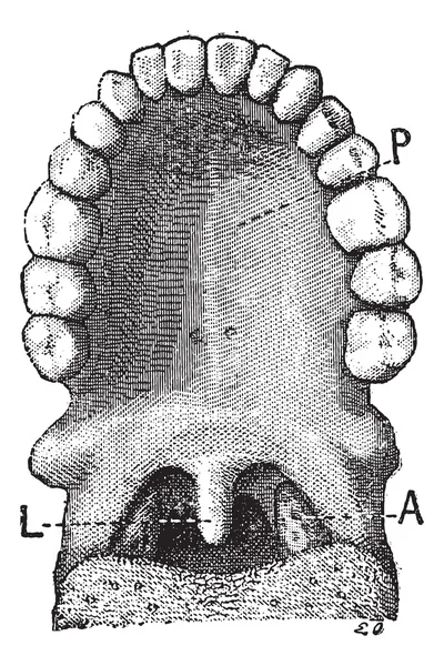 The palatine uvula or uvula, vintage engraving. — Stock Vector