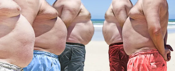 Pięć bardzo otyłych mężczyzn tłuszczu na plaży — Zdjęcie stockowe