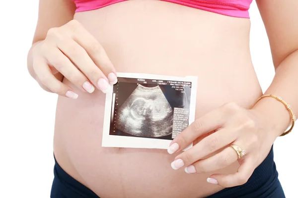 Κοιλιά εγκύου γυναίκας και το υπερηχογράφημα πάνω από το λευκό φόντο. — Φωτογραφία Αρχείου