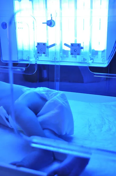 Pasgeboren geelzucht — Stockfoto