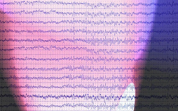 Хвиля мозку графа EEG ізольована на білому тлі — стокове фото