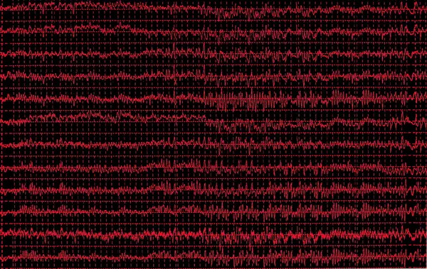 Gráfico rojo onda cerebral eeg aislado sobre fondo negro, textura — Foto de Stock