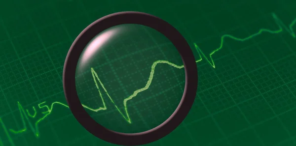 Ηλεκτροκαρδιογράφημα ΗΚΓ με μεγεθυντικό φακό σε πράσινο φόντο — Φωτογραφία Αρχείου