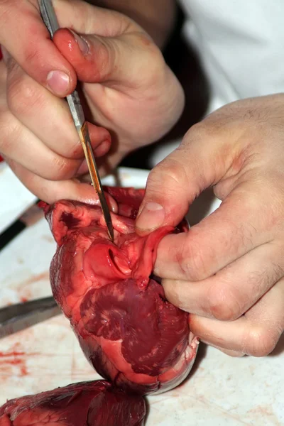 stock image Dissection of a heart